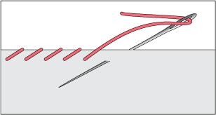 WhipStitch